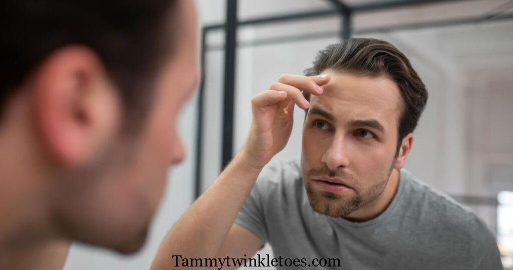 Best Hair Systems for Men in 2026: The Complete Buyer’s Guide 